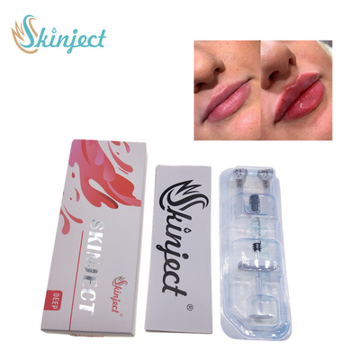 Skinject Deep Hyaluronic Acid Dermal 2ml ฟิลเลอร์ริมฝีปาก Injectable