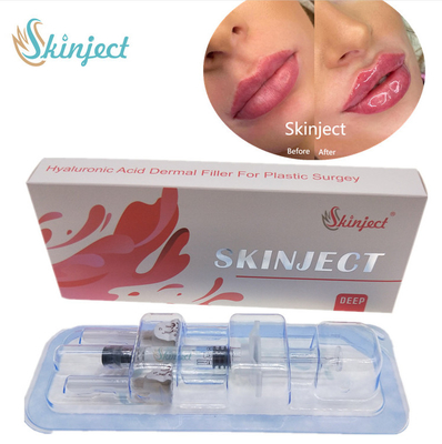 Injectable Skinject Deep HA Dermal 2ml ฟิลเลอร์ริมฝีปาก แก้ม คาง Nasolabial Fold