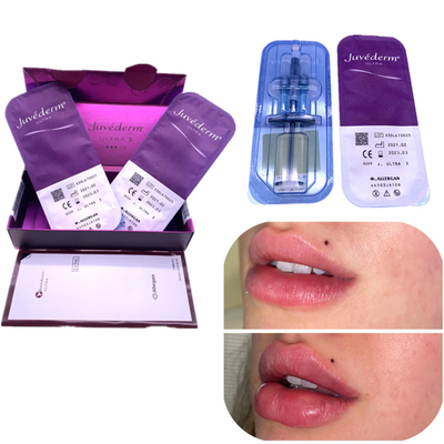 ฉีดฮา ฟิลเลอร์ Juvederm 2x1ml Lip Enhancement Remove Wrinkles