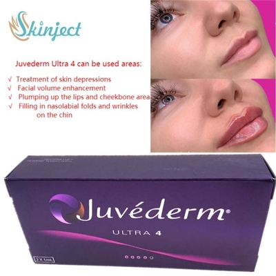 การดูแลผิวหน้า 2x1ml Juvederm Lip Fillers กรดไฮยาลูโรนิก Dermal Injectable