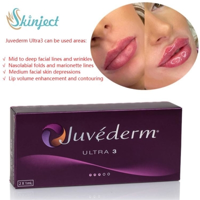 การดูแลผิวหน้า 2x1ml Juvederm Lip Fillers กรดไฮยาลูโรนิก Dermal Injectable