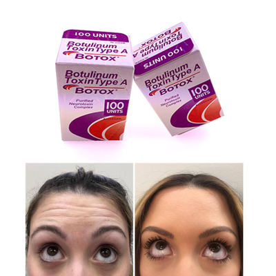 100 IU Allergan  Botulinum Toxin English Edition