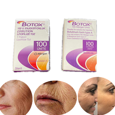 English Edition Type A Botulinum Toxin 100 Iu Allergan โบท็อกซ์สำหรับริ้วรอย