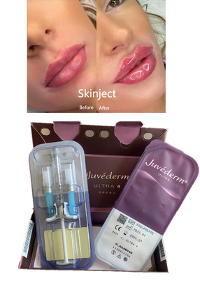 Lips Reshape Juvederm Hyaluronic Acid Dermal Filler With Lido Ultra4 2X1ml