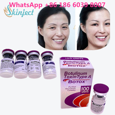 Botulinum Toxin  Wrinkle Removal 100u Allergan 100 Units สำหรับการฉีดยกกระชับใบหน้า