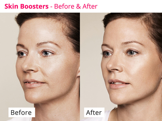 Hyamely Skin Regeneration กระตุ้น Collagen PDRN Serum Transparent Liquid