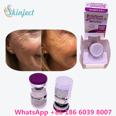 Botulinum Toxin Allergan  Type A 100units 1 ขวด/กล่องบรรจุ