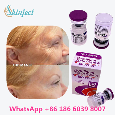 Botulinum Toxin Allergan  Type A 100units 1 ขวด/กล่องบรรจุ