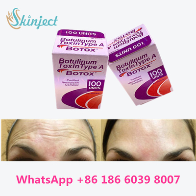 Botulinum Toxin Allergan  Type A 100units 1 ขวด/กล่องบรรจุ