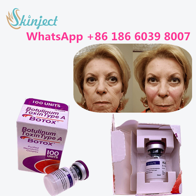 allergan botulinum toxin Anti Aging Products ประเภท A Toxin Anti Wrinkle