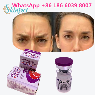 Botulinum Toxin ของแท้ 100%  100u สำหรับลบริ้วรอย