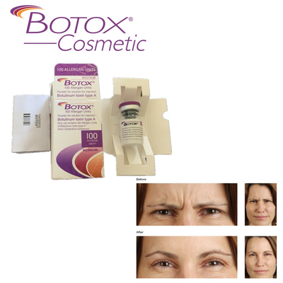 Allergan ฉีดโบท็อกซ์สำหรับริ้วรอยหน้าผาก 100ui