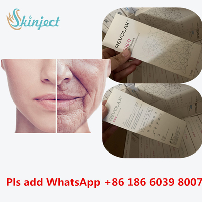 Hyaluronic Acid Dermal Revolax Deep Filler 1ml สำหรับฉีดริมฝีปาก