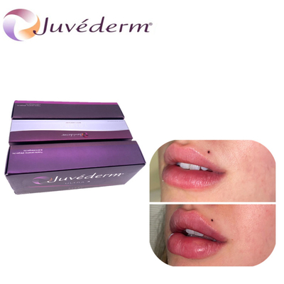 Injectable Dermal Filler Ultra3 Ultra4 Voluma สำหรับโหนกแก้ม