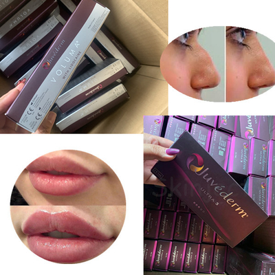 Ultra 3 Ultra 4 Juviderm Cross Linked Dermal Filler ปราศจากเชื้อพร้อมใบรับรอง CE
