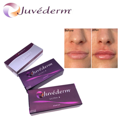 ไฮลูรอนิกแอซิด Dermal Filler Premium Juvederm HA เติมหน้า Ultra3 Ultra4 Voluma สําหรับการเยียวยาใบหน้า