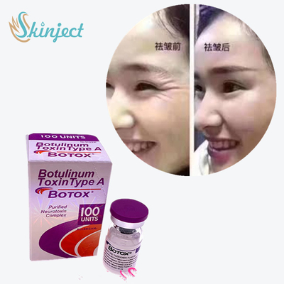 100 Units Type A Botulinum Toxin 2 - 8°C อุณหภูมิในการจัดเก็บ