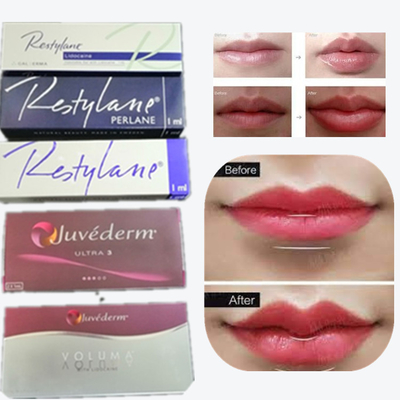 Juvaderm Hyaluronic Acid Pen Filler ขนาดลึก ขนาดละเอียด