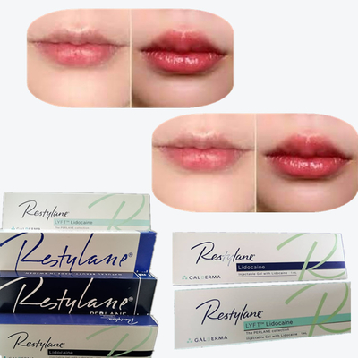 2*1ml/Box Cross Linked Dermal Filler สําหรับการขยายริมฝีปาก