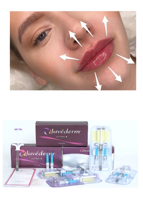 Juvederm' Hyaluronic Acid Dermal Filler Ultra3 Ultra4 Voluma Injection สําหรับการเติมฝีปาก