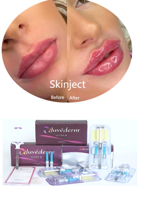 Juvederm Hyaluronic Acid ผิวหน้า เติมสารฉีด 2*1ml แพ็ค
