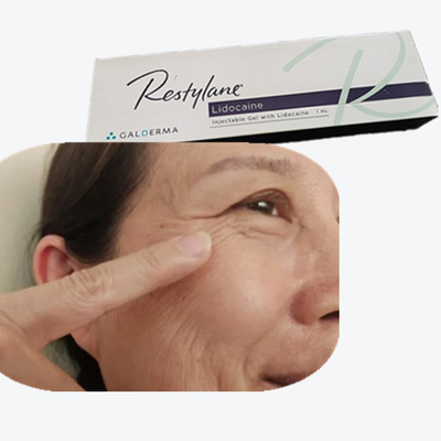 2*1ml/กล่อง Hyaluronic Acid Breast Filler HA Dermal Fillers สําหรับเส้นหน้าผาก
