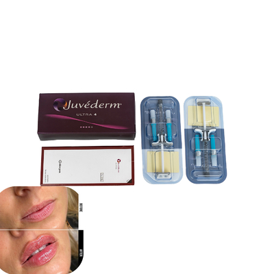 Juvederm Dermal Filler For Lips Injection Hyaluronic Acid Fillers เครื่องเติมกรดไฮยอลูรอนิค
