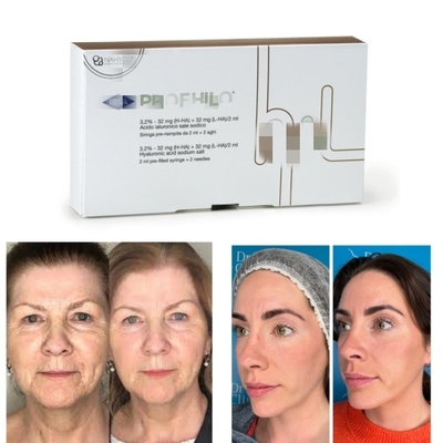 ลิฟท์ 5 จุดที่ดูเป็นธรรมชาติ Profhilo Injectable Dermal Filler