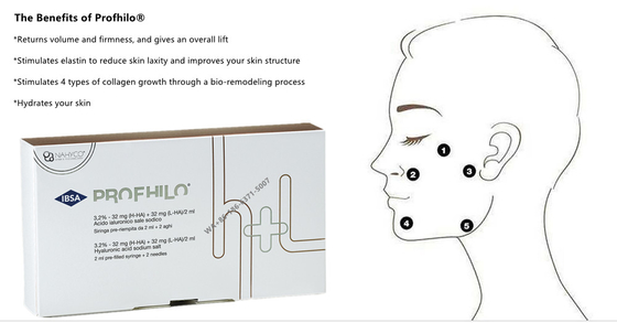สารเติมเต็มผิวหนังแบบ Cross Linked 2 มล. PROFHILO ทรีทเม้นท์ผิวต่อต้านริ้วรอย ใบหน้า ขาวใส มีประสิทธิภาพในการฟื้นฟูผิว