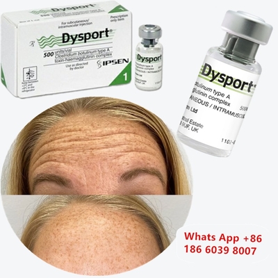 โบทูลินัม ท็อกซิน ชนิด A สำหรับริ้วรอยใต้ตา (Dysport)