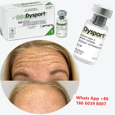 การฉีดสารโบทูลินัม ท็อกซิน ชนิด A (Dysport) เพื่อลดเลือนริ้วรอย