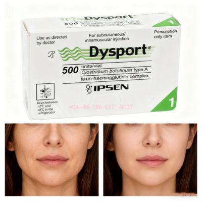 โบทูลินัม ท็อกซิน 500U Dysport ลดเลือนริ้วรอยบนใบหน้าและฟื้นฟูผิวให้เรียบเนียน