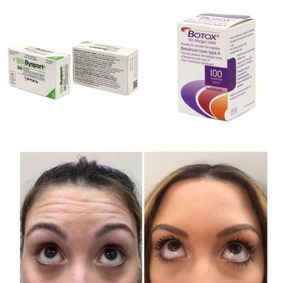 100 หน่วย เกาหลี BTX ยาพิษโบทูลินัมสําหรับรอยหดและเส้น Fine