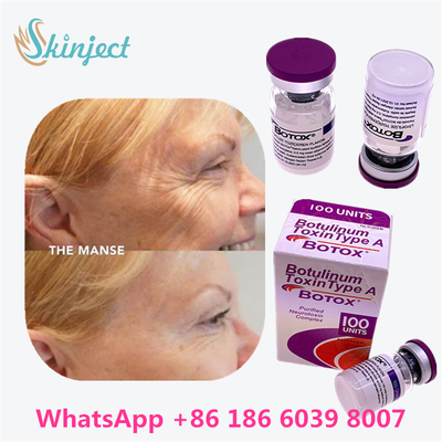 โบทูลินัม ท็อกซิน BOTOX คอสเมติก 100 ยูนิต Allergan OnabotulinumtoxinA สำหรับริ้วรอยบนใบหน้า