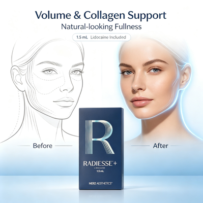 Radiesse การฉีดคอลลาเจน เพิ่มเติม Filler สําหรับใบหน้า การแก้ไขทันทีสําหรับเส้นลึก
