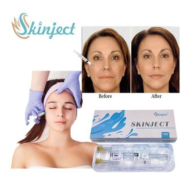 Skinject 1ml Fine Hyaluronic Acid Filler Anti Aging ต่อต้านริ้วรอยฉีด Dermal Filler