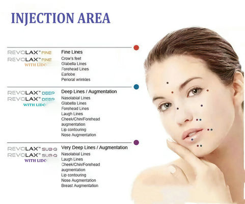 Revolax Hyaluronic Acid Facial Fillers สำหรับการขยายใบหน้า