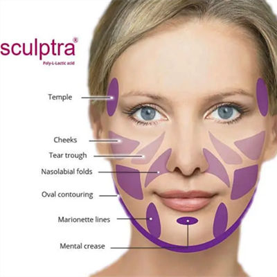 CE  PLLA Powder สำหรับกระตุ้นคอลลาเจน