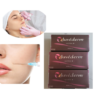 การฉีด Juvederm 2x1ml Ultra 3 Lip Dermal Filler 24mg / Ml