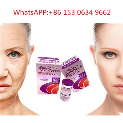 50u 100u 150u Type A Allergan  ฉีด Botulinum Toxin สำหรับต่อต้านริ้วรอย