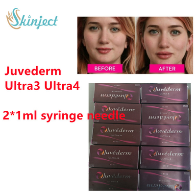 Juvederm Hyaluronic Acid Dermal Filler Juvederm Lip Filler พร้อม  2x1ml Ultra3 Ultra4