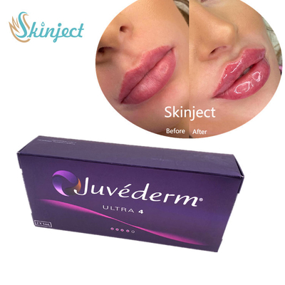Juvederm 2*1ml Lips Filler Hyaluronic Acid Dermal Filler With Lido Ultra4