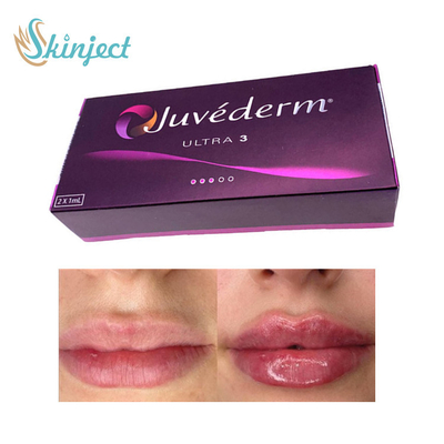 281ML ฟิลเลอร์กรดไฮยาลูโรนิก Juvederm Ultra3 Dermal