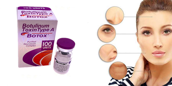 Allergan Botulinum Toxin Type A แบบฟอร์มผงโบท็อกซ์