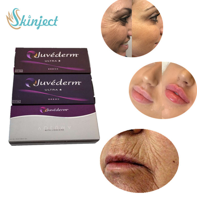 Juvederm Ultra 4 Dermal Filler Lip Injections สำหรับการเพิ่มประสิทธิภาพริมฝีปากเซ็กซี่