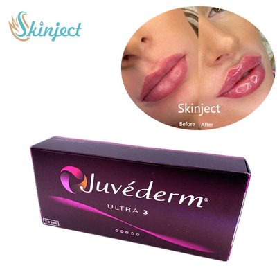Juvederm Ultra3 2x1ml Hyaluronic Acid Facial Fillers Dermal