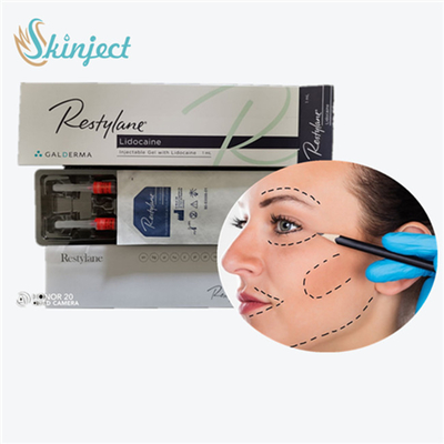 Cross Linked Dermal Filler  LYFT สำหรับการเติมเต็มหน้าผาก