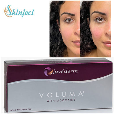 Juvederm Voluma 2x1ml HA Dermal Fillers สำหรับโหนกแก้มคาง Contouring