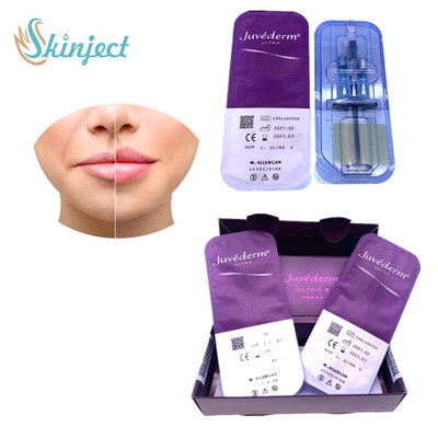 Juvederm Ultra4 Lip Enlargement Dermal Fillers กรดไฮยาลูโรนิก