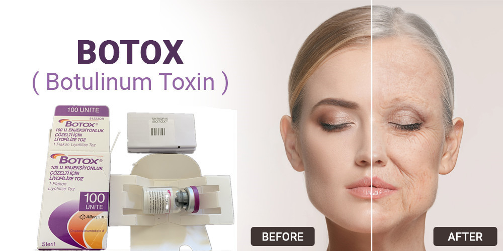 100Units Allergan Botulinum Toxin Type A ฉีดสำหรับกำจัดริ้วรอยบนใบหน้า